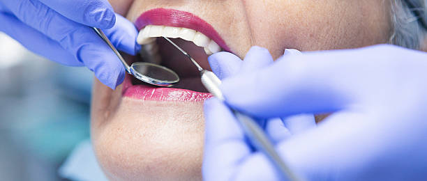 Best Emergency Tooth Extraction in Midway North, TX